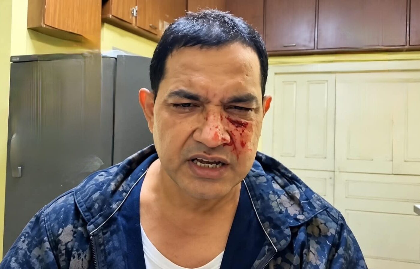 মুকুন্দপুরে মিছিল ঘিরে সংঘর্ষ, আহত প্রাক্তন বিধায়ক হুমায়ুন কবীর