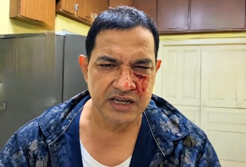 মুকুন্দপুরে মিছিল ঘিরে সংঘর্ষ, আহত প্রাক্তন বিধায়ক হুমায়ুন কবীর